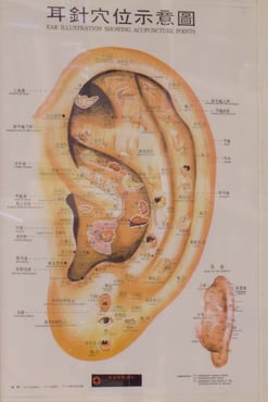 Ear acupuncture chart