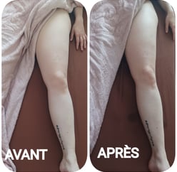avant/après massage renata franca grenoble
