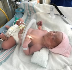 a baby in a hospital bed with a baby in a clear glass case
