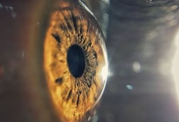 Corneal Care