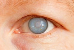 Glaucoma Care