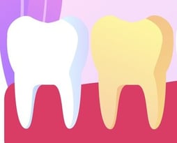 causes demineralisation of teeth hygiene-precision.com