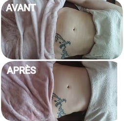 avant/après massage renata franca grenoble