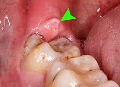 expert in oral surgery