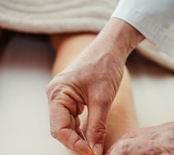 Acupuncture