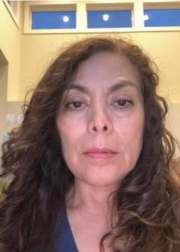 Face Yoga Result - After
