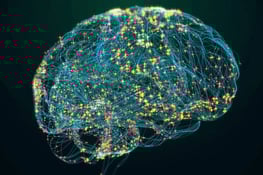 a brain map of a brain scanplant