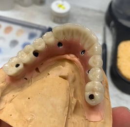 Procad Henares, rehabilitación inferior metal cerámica