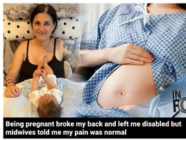Being pregnant broke my back