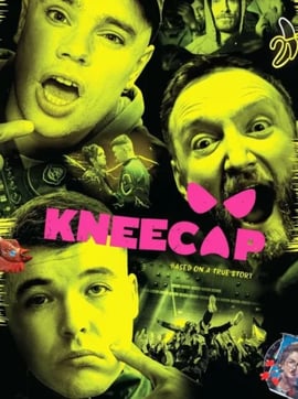 Kneecap