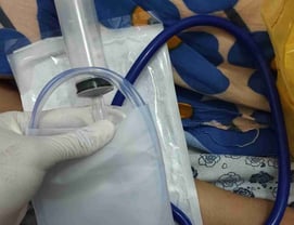 a person in a hospital gown holding a stethoscope attached to a medical
