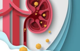 Renal Stones