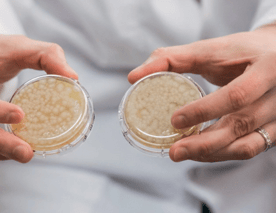 Pourquoi des probiotiques dans le nettoyage