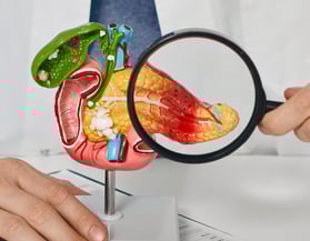 Ca Pancreas