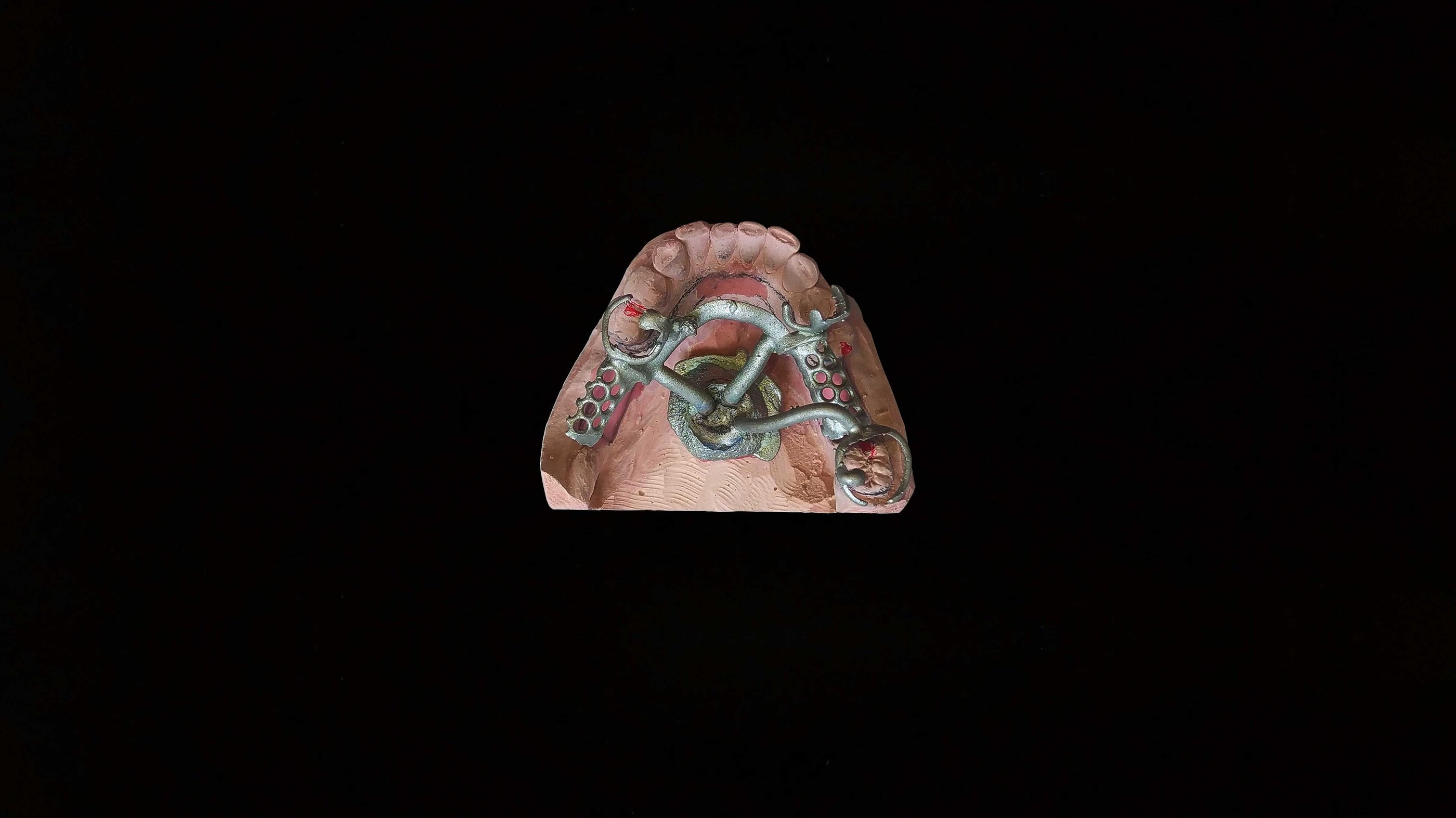 Removible estructura metalica