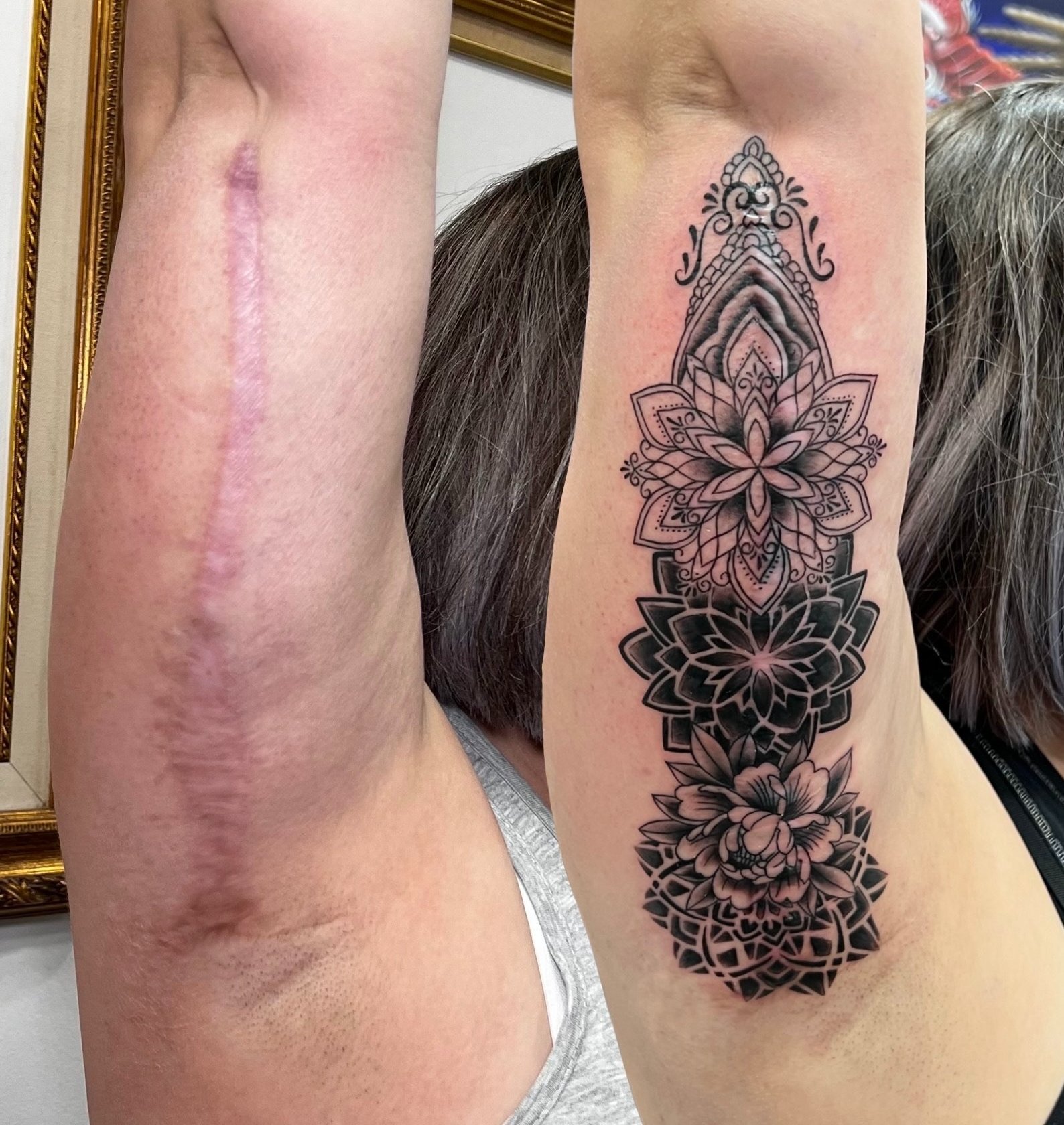 La cicatriz de Dana | Secret Tattoo Barcelona, image size:1588x1680