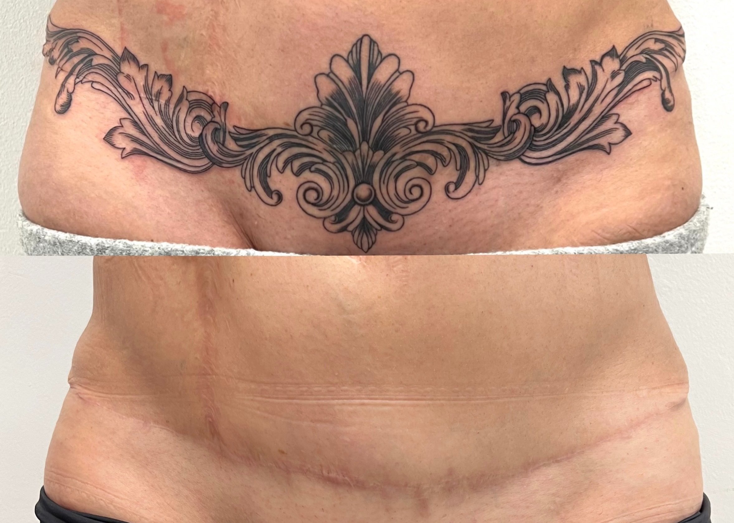 Cicatriz por recorte de piel. | Secret Tattoo Barcelona, image size:2357x1680