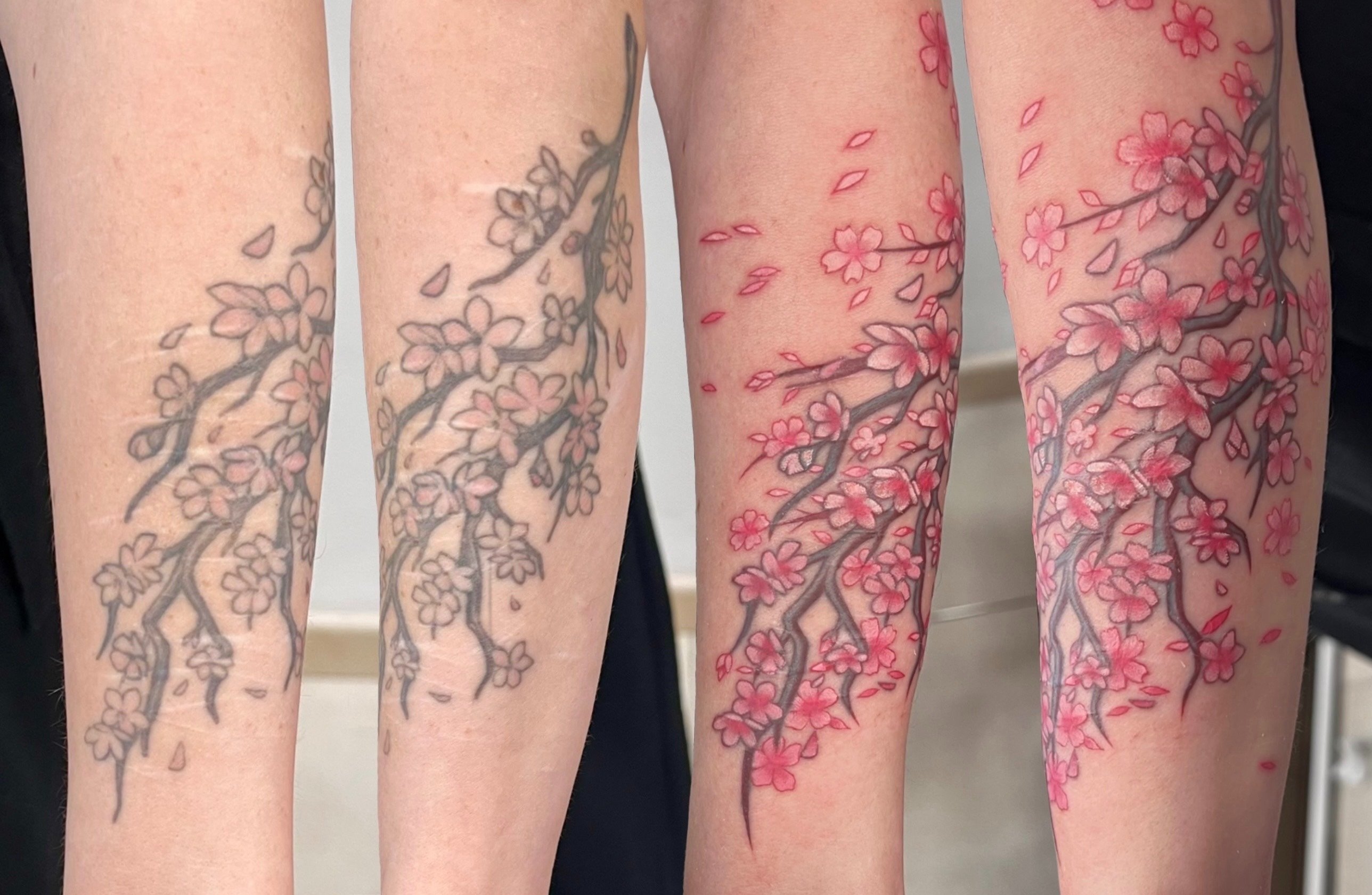 Blog sobre cicatrices. | Secret Tattoo Barcelona, image size:2576x1680