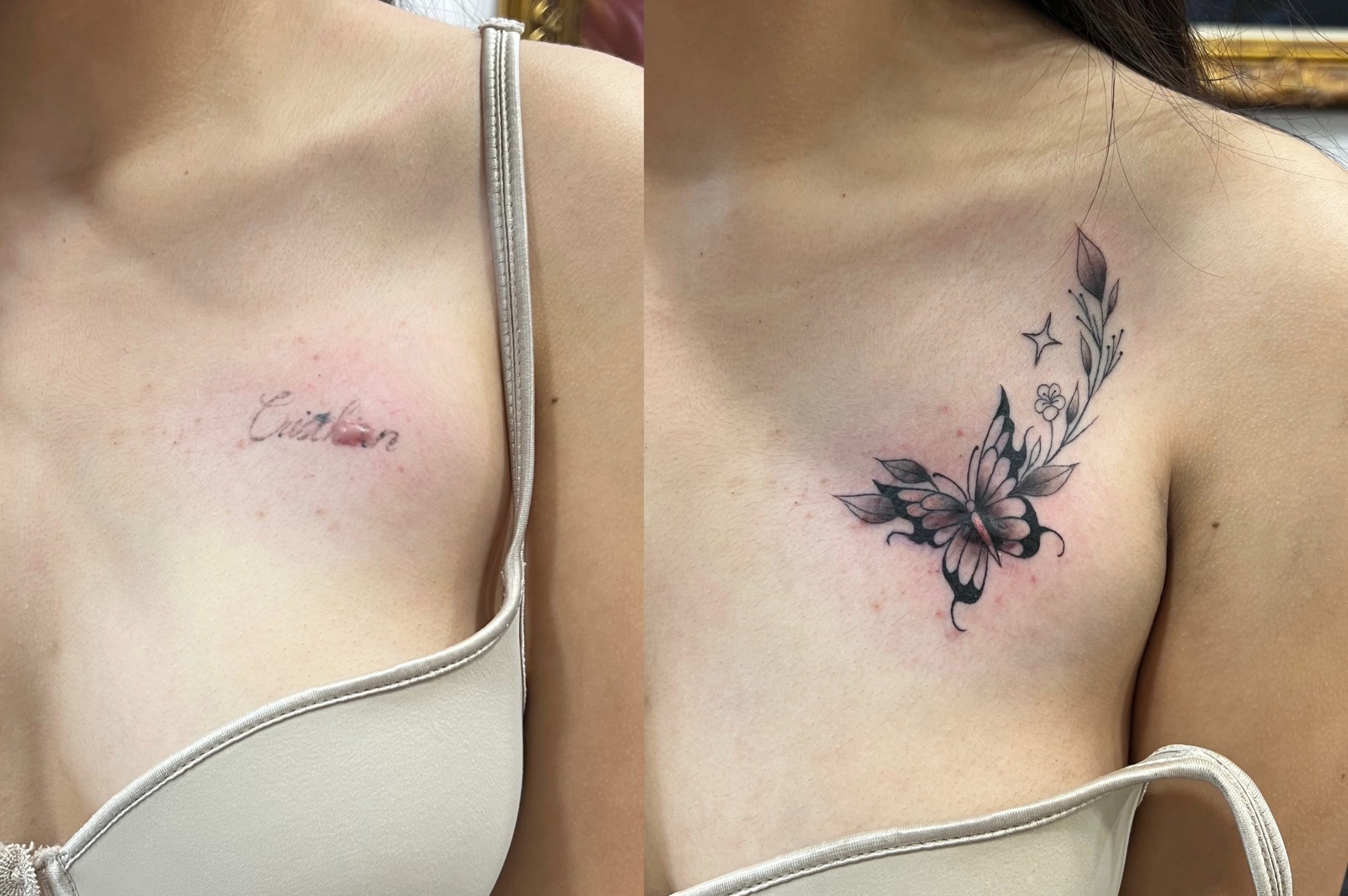 Blog sobre cicatrices. | Secret Tattoo Barcelona, image size:2528x1680