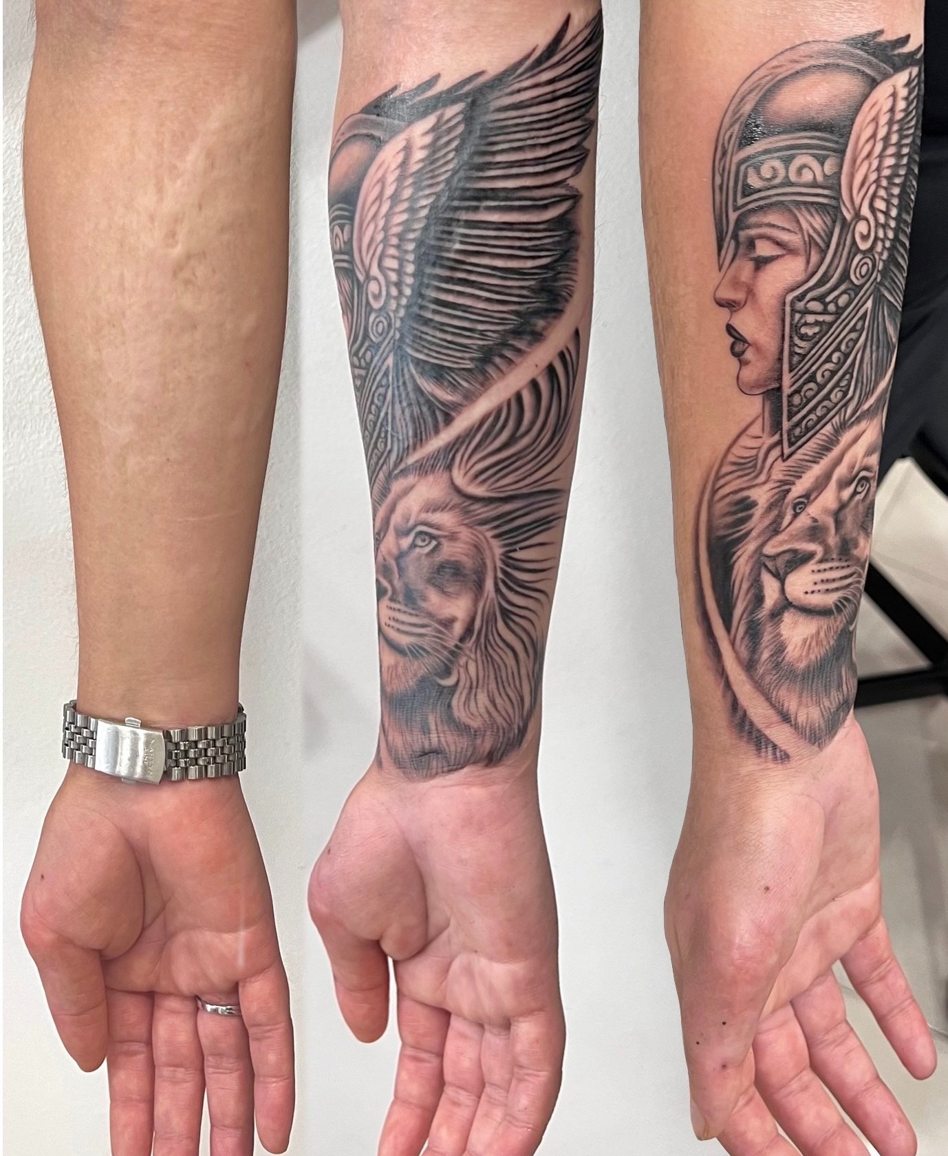 Blog sobre cicatrices. | Secret Tattoo Barcelona, image size:1378x1680