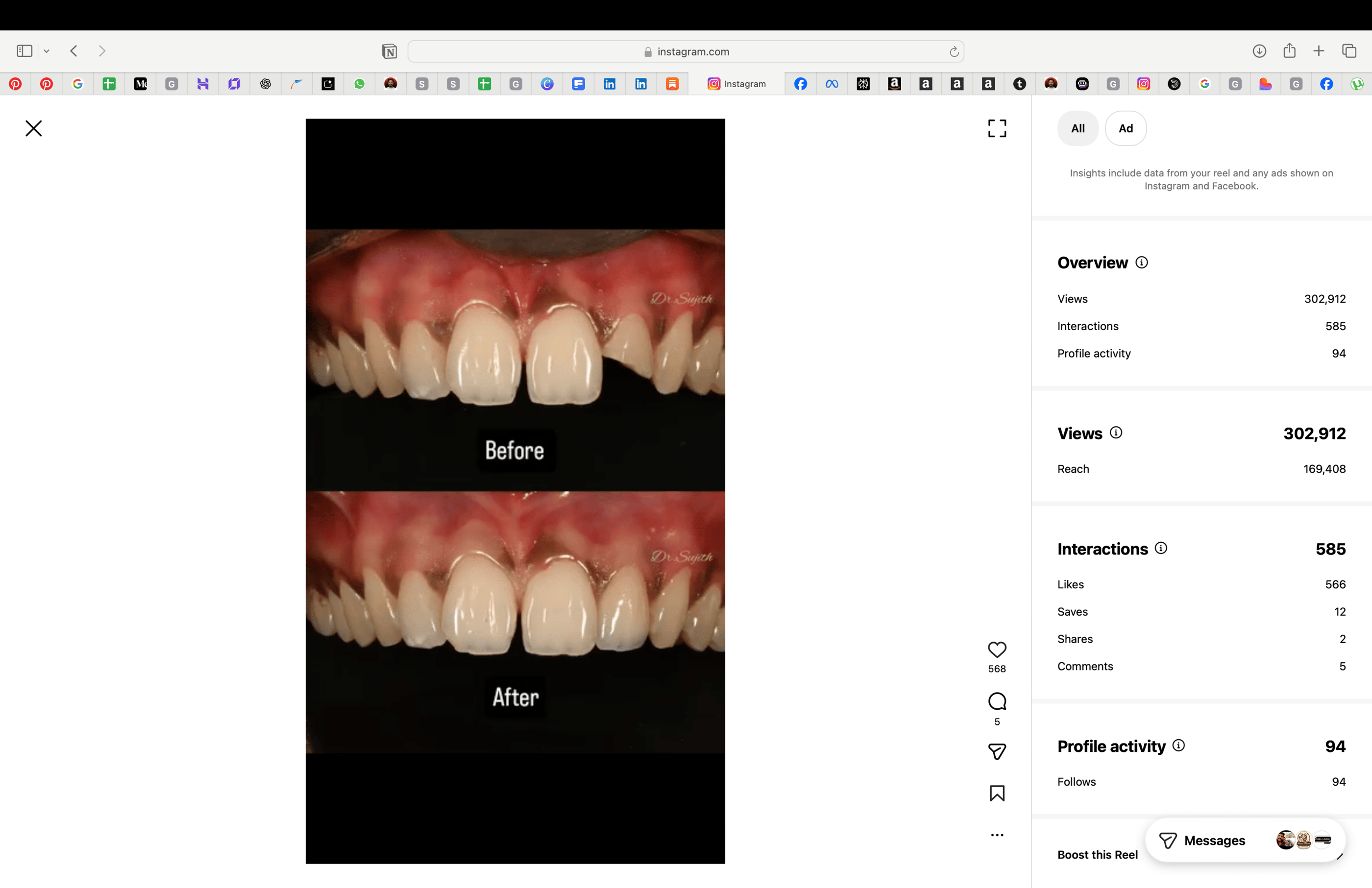 WhatsApp Business Marketing Services India – Digital With Dhana
