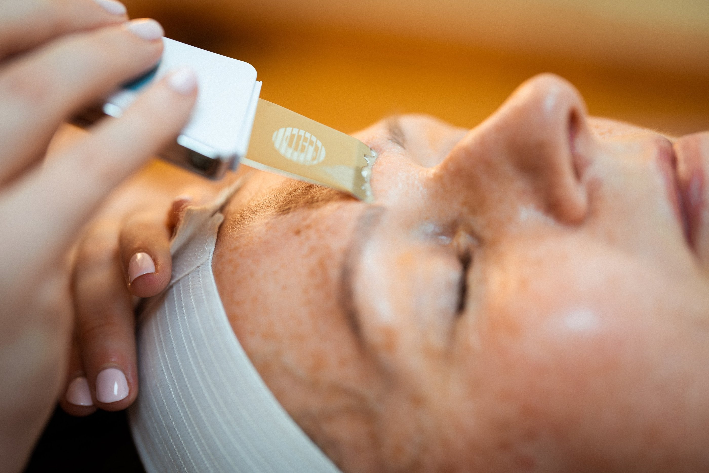 Calming enzyme peel facial for sensitive, acne-prone skin in Ashford Kent.