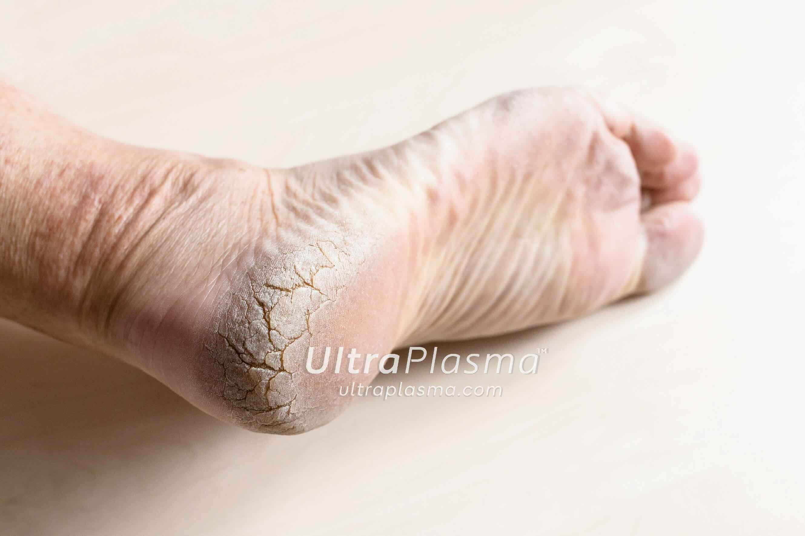 ultra_plasma_ultra_plazma_ultra-plasma_ultra-plazma