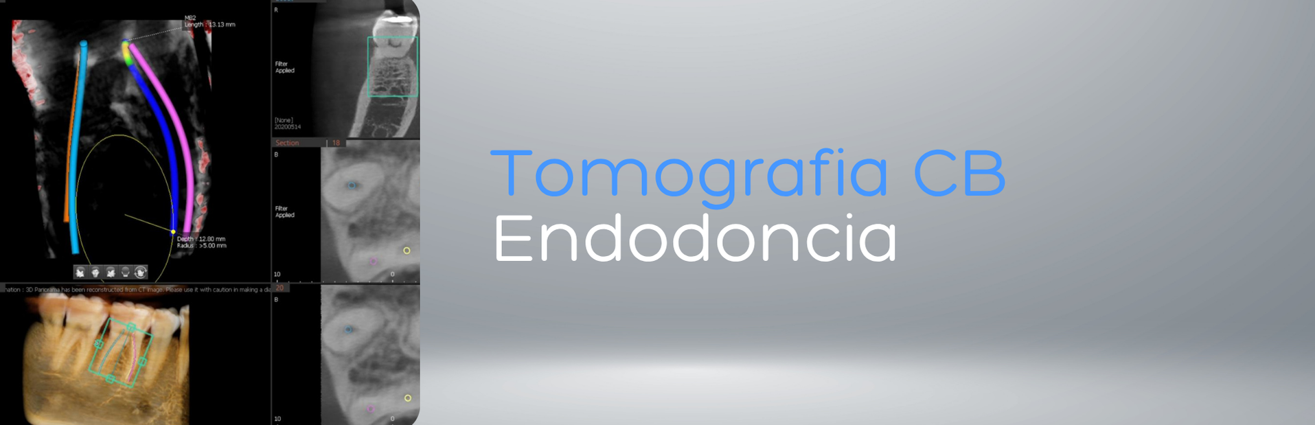 Radiografía Panorámica