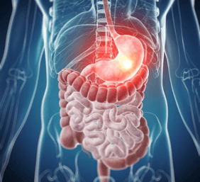 Gastrointestinal cancer