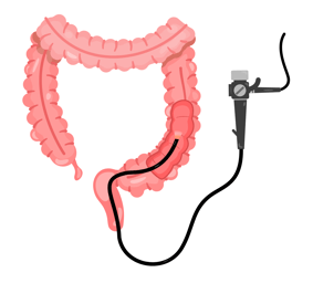 Colonoscopy in ahmedabad