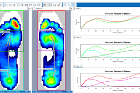 foot pressure mapping