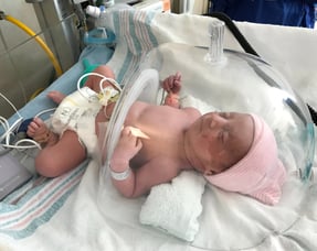 a baby in a hospital bed with a baby in a clear glass case