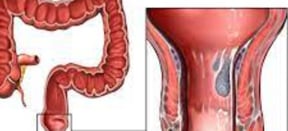 the small intestine beyond the duodenum, the colon, rectum, and anal canal.