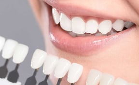 Best Preventative Dental Care Service