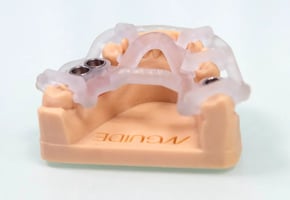 Precio de implantes dentales en sevilla