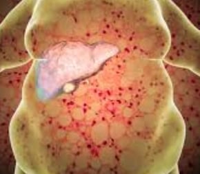  honey good for liver repair inflammation cirrhosis