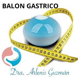 Imagen sin fondo de balón gástrico, utilizada en el sitio web de la Dra. Arlenis Guzán