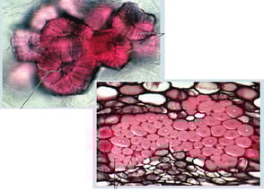 Structure plante vasculaire - cellules sclérenchymeuses