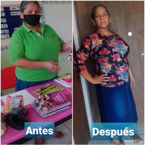 antes y después de mujer mayor