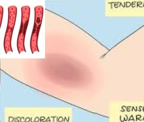 💧🩺 Why doesn’t dehydration during voluntary fasting lead to dangerous blood clots? Discover how th