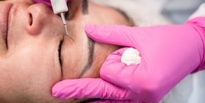 medicina estetica blefaroplastica non chirurgica rovereto trento