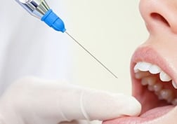 a woman is getting her teeth filled with a dermal filler
