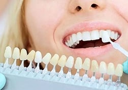 Smiling young woman with selection of the tone of the implant tooth