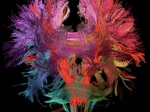 A picture of brain fibers