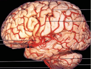 A picture of brain vasulature