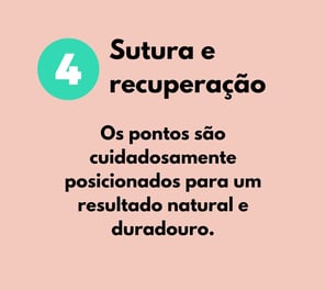 O número 4 em um círculo verde e texto sobre a otoplastia