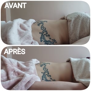 avant/après drainage renata franca grenoble