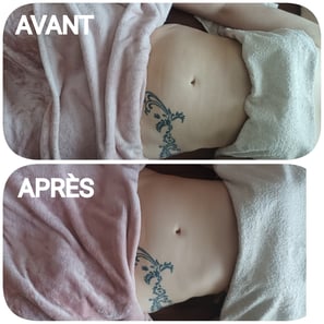 avant/après massage renata franca grenoble