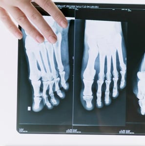 Foot Bones in an Xray Image and Link to AnatomyVideo.com