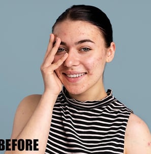 portrait-photo-retouching-before